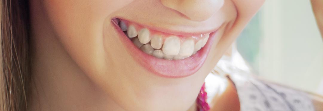wybielanie zębów u stomatologa
