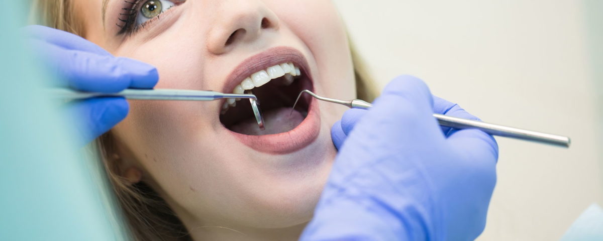 aparat retencyjny w ortodoncji, kiedy dentysta zleca noszenie retainera
